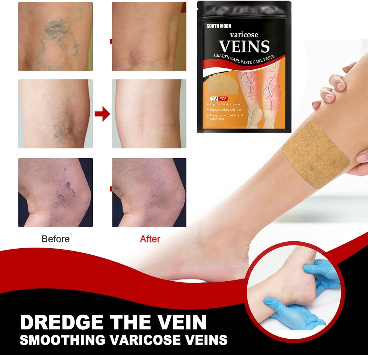 Patchs Herbales Anti-Varices Soulagement Douleur, Amélioration Circulation 12Pcs - لاصقات الأعشاب الطبيعية لعلاج الدوالي والدورة الدموية