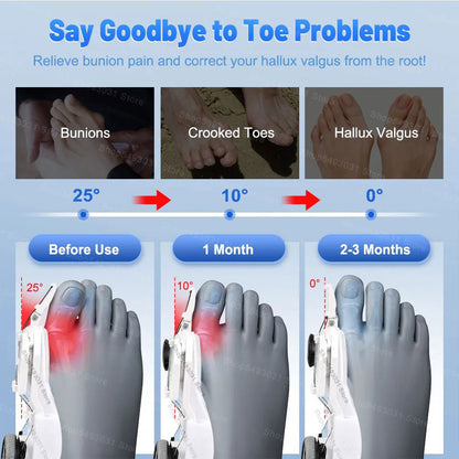 Correcteur Hallux Valgus pour Femme et Homme avec Molette Réglable – مصحح وضعية القدم