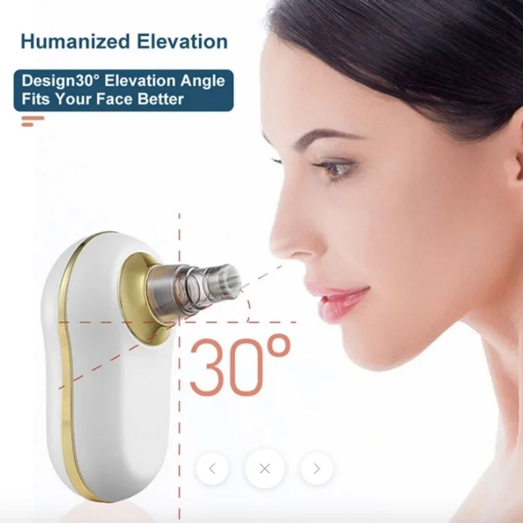 Aspirateur de Points Noirs – جهاز شفط الرؤوس السوداء لتنظيف البشرة