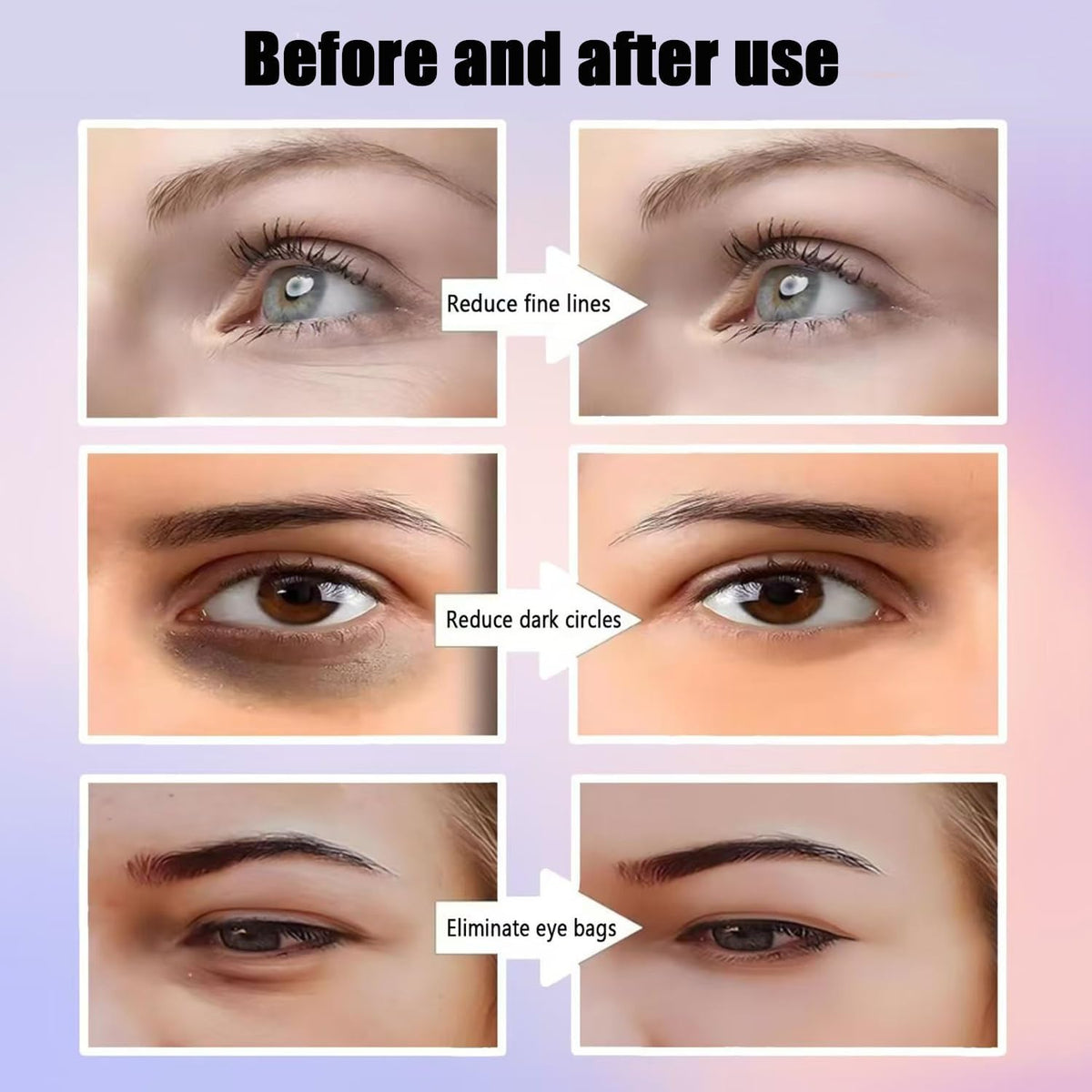 Masseur Yeux Rajeunissant Anti-Poches par Photothérapie Lumière Rouge - نظارة وقناع مساج وتجميل محيط العين بالضوء الأحمر والاهتزاز