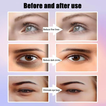 Masseur Yeux Rajeunissant Anti-Poches par Photothérapie Lumière Rouge - نظارة وقناع مساج وتجميل محيط العين بالضوء الأحمر والاهتزاز